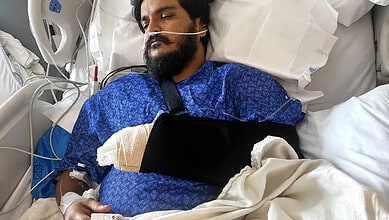 Man in hospital bed with oxygen tube and medical equipment, appearing injured.