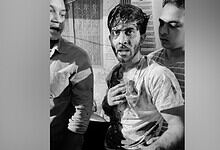 Man with injuries being assisted by two others in a black and white photo.