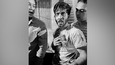 Man with injuries being assisted by two others in a black and white photo.