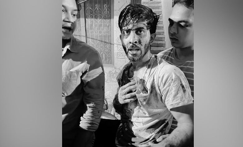 Man with injuries being assisted by two others in a black and white photo.
