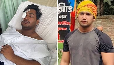 Young man with a head injury lying in hospital bed, eyes closed, bandage on his forehead.