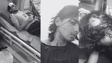 Students injured during EFLU clash, some with head injuries and in hospital beds.