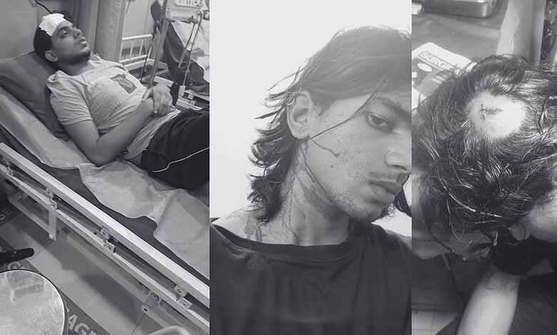 Students injured during EFLU clash, some with head injuries and in hospital beds.