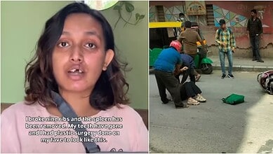 Bengaluru woman speaks about her near-fatal accident and lack of support from Rapido.