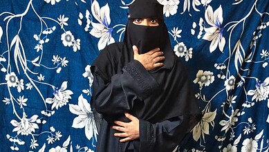 19 years, 7 surgeries: Hyderabad woman seeks help for 8th operation