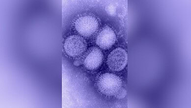 Microscopic view of H1N1 influenza virus particles in purple hues.