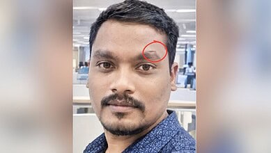 Hyderabad burglary