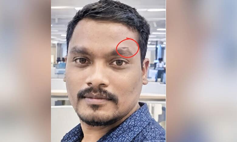 Hyderabad burglary