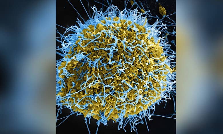 Microscopic view of a virus particle with yellow and blue structures.