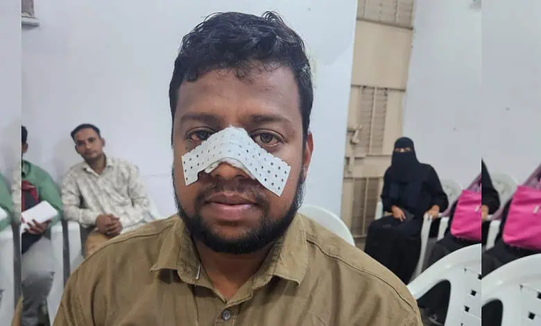Hyderabad: Cab driver assaulted near Begumpet, MBT seeks action