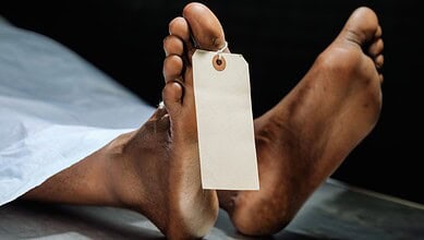 Dead body with a tag attached, lying on a surface in a crime scene or medical setting.