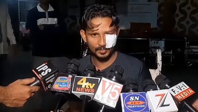 Man with eye injury speaks to media after attack near Gulzar Houz, Hyderabad.