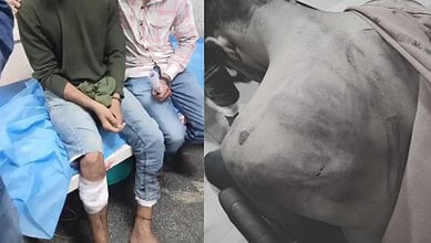 Youths sitting with injuries after assault at Shamshabad site, MBT demands action.