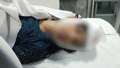 Injured person lying on hospital bed after falling light fixture incident in Hyderabad.