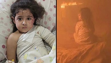 Young girl with injuries lying in hospital bed after Israeli strike in Gaza.