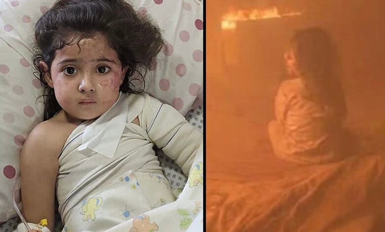 Young girl with injuries lying in hospital bed after Israeli strike in Gaza.