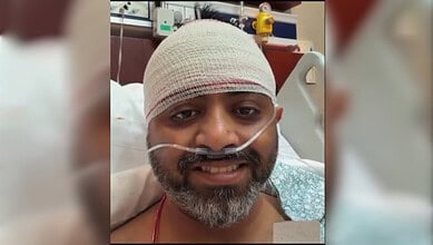 Injured Indian pilot Smit Machchhar smiling in hospital bed with bandage and oxygen tube.